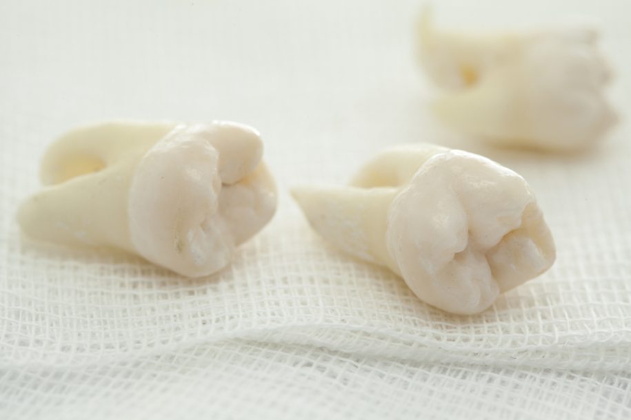 Removed wisdom tooth on white