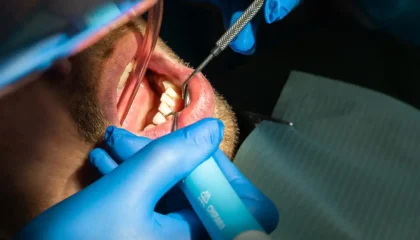 Eat After Root Canal