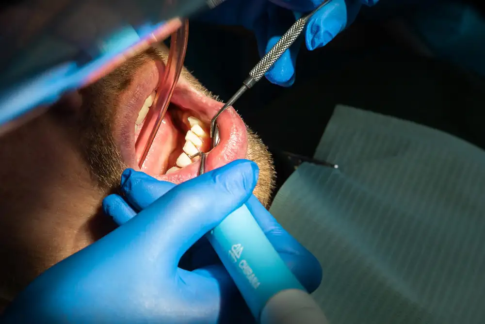 Eat After Root Canal