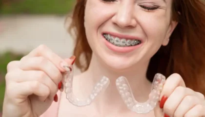 Invisalign and Braces